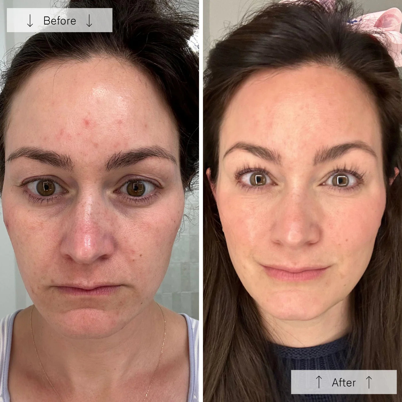 the Ultimate Regenerative Duo: INVO Regenerating Complex + Omnilux® LED Mask