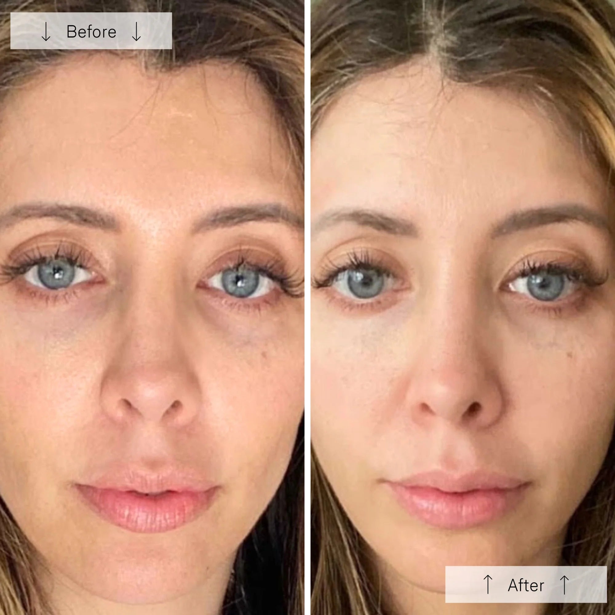 the Ultimate Regenerative Duo: INVO Regenerating Complex + Omnilux® LED Mask