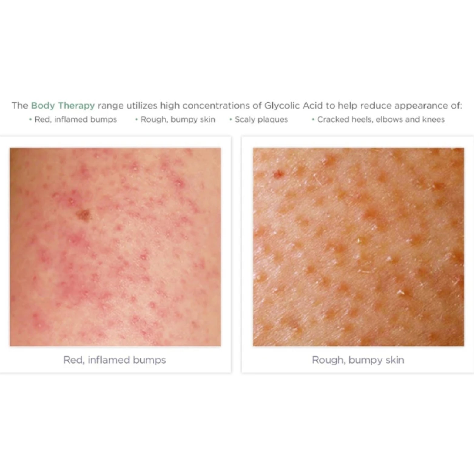 Glytone Exfoliating Body Wash