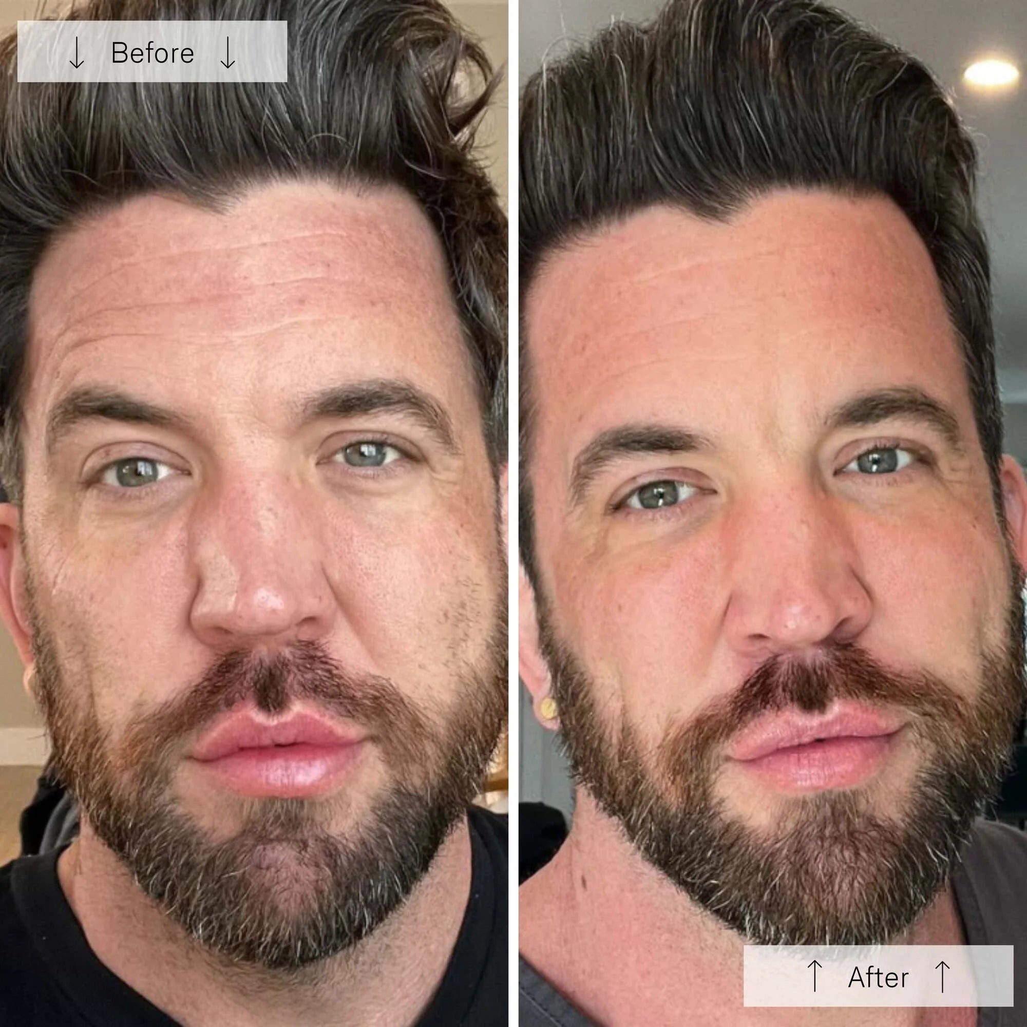 the Ultimate Regenerative Duo: INVO Regenerating Complex + Omnilux® LED Mask