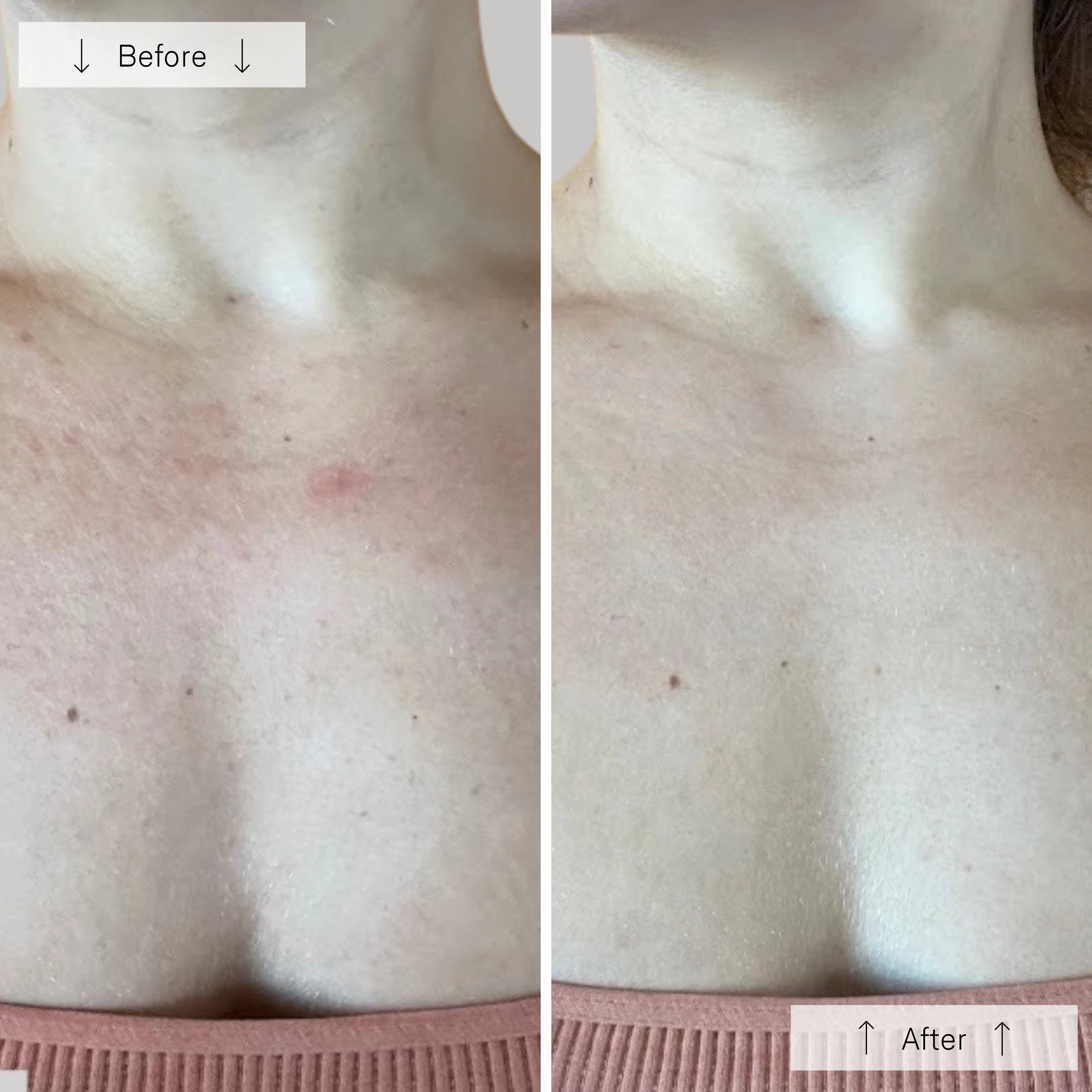 the Ultimate Regenerative Duo: INVO Regenerating Complex + Omnilux® LED Mask