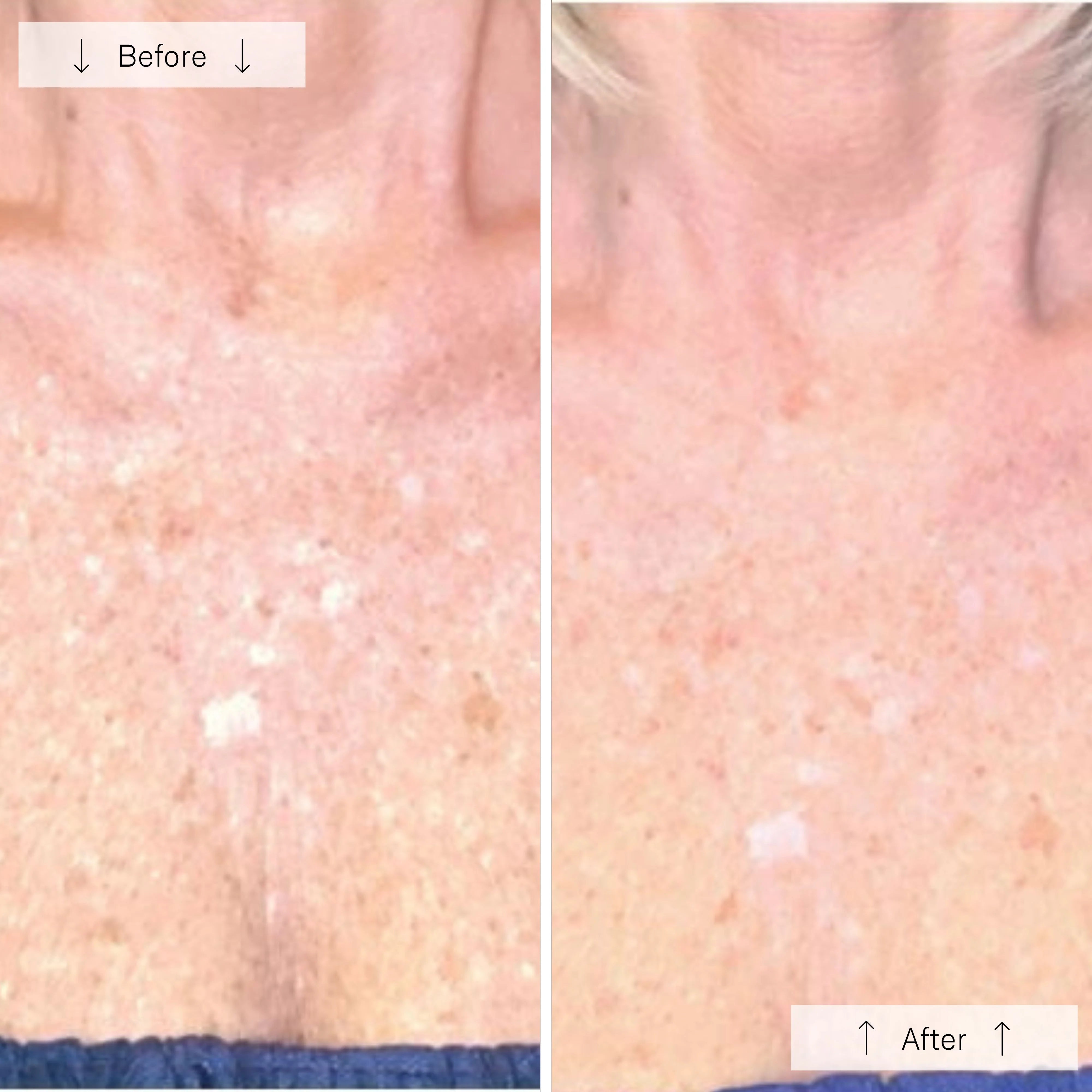 the Ultimate Regenerative Duo: INVO Regenerating Complex + Omnilux® LED Mask