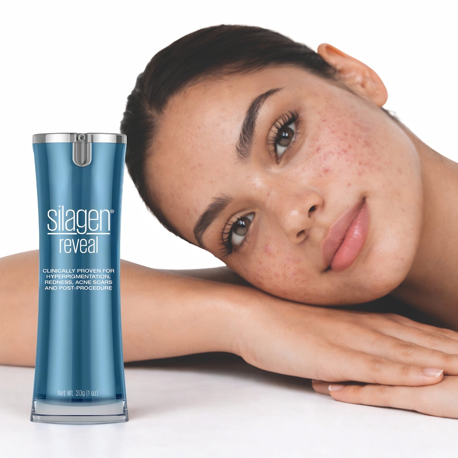 Silagen® Reveal