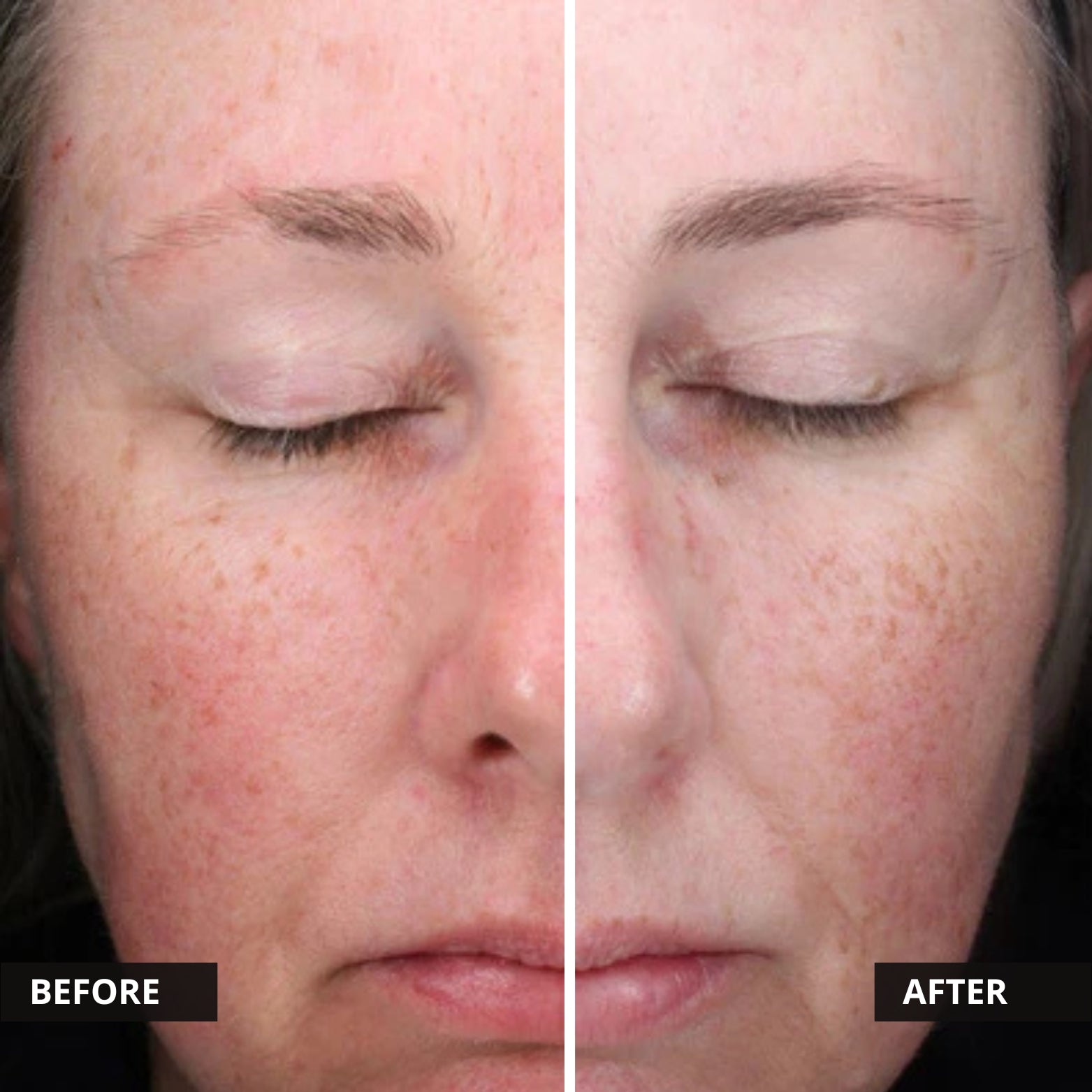 Alastin C-RADICAL Defense Antioxidant Serum