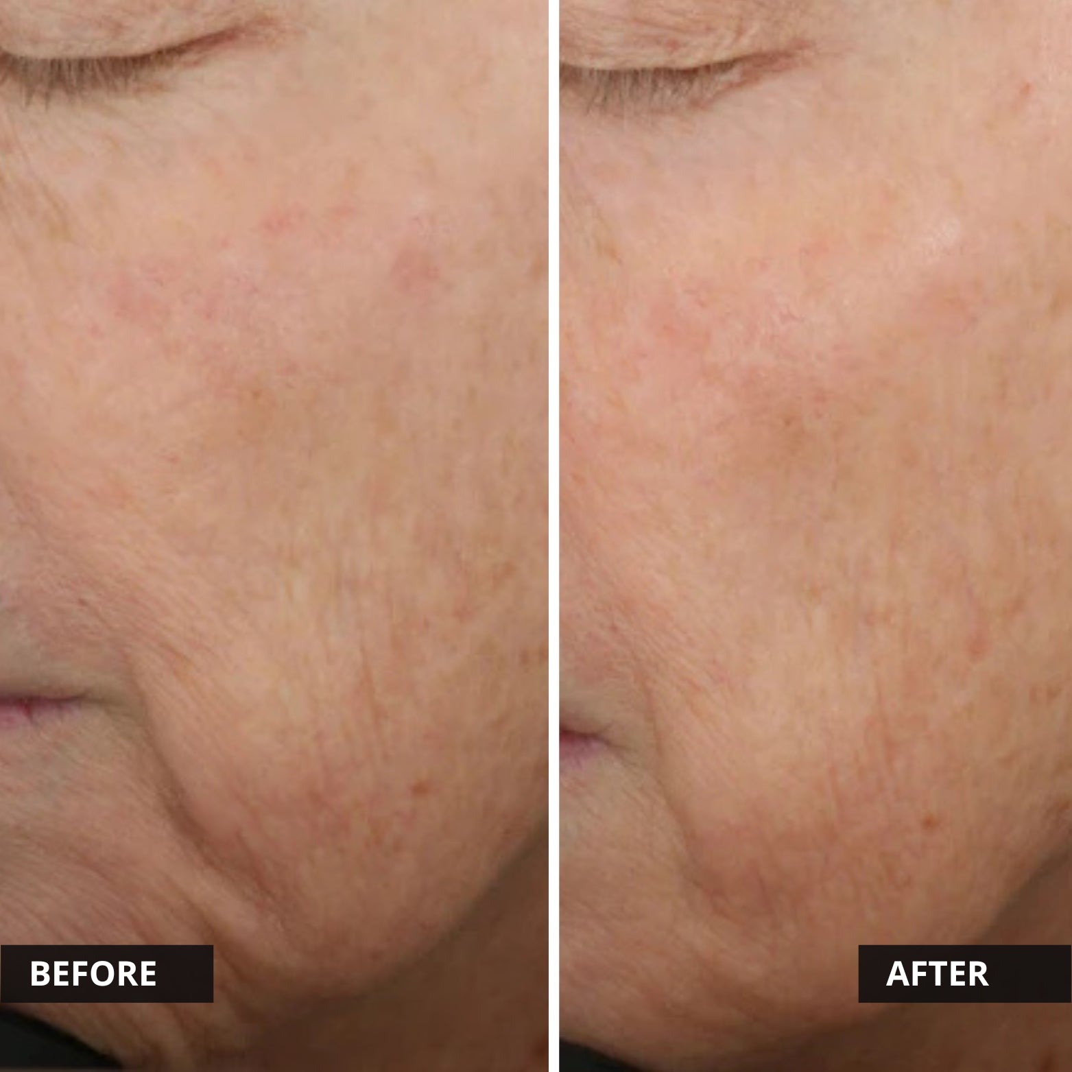 Alastin Restorative Skin Complex with TriHex+™