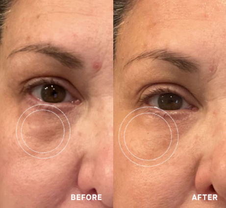 OneSkin OS-01 EYE Topical Supplement