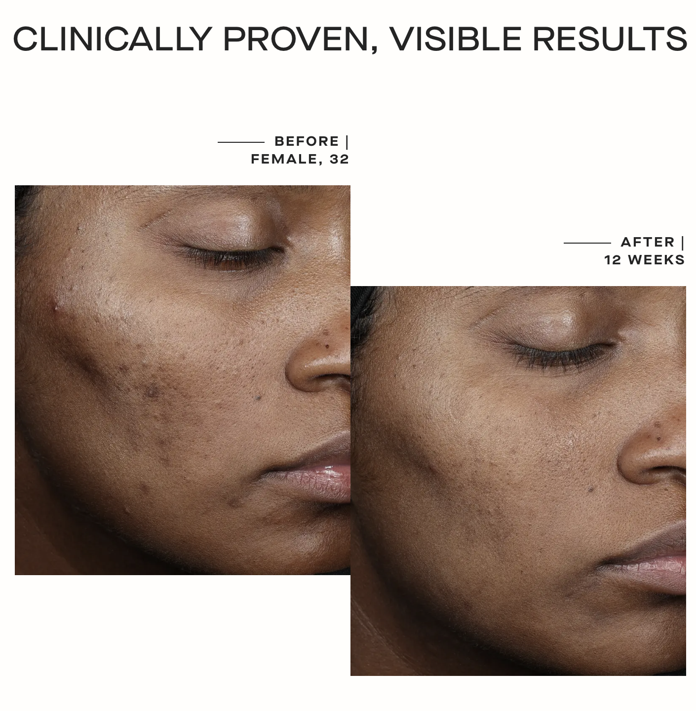 Ourself Complexion Brightening Serum