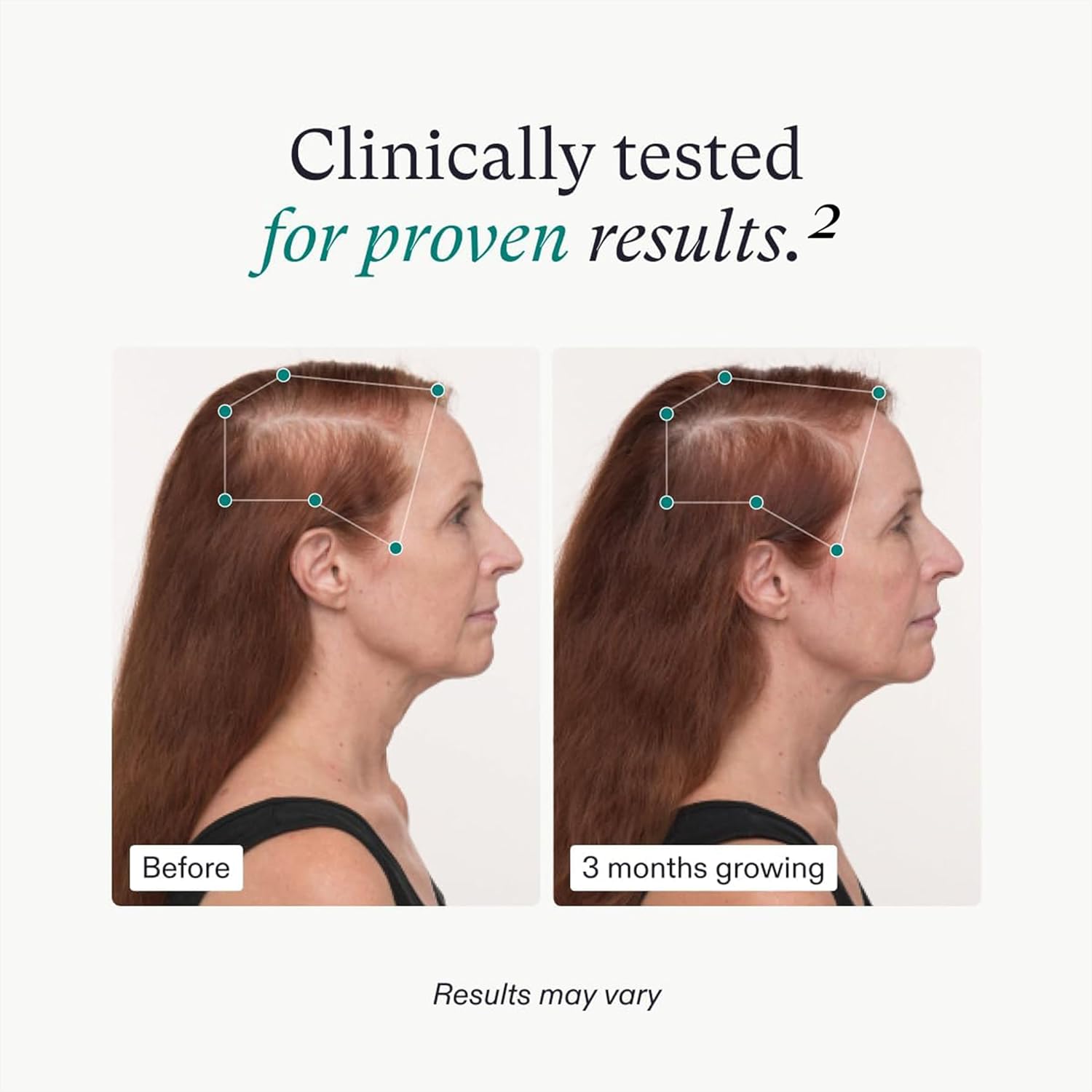 Nutrafol Women's Balance image 1