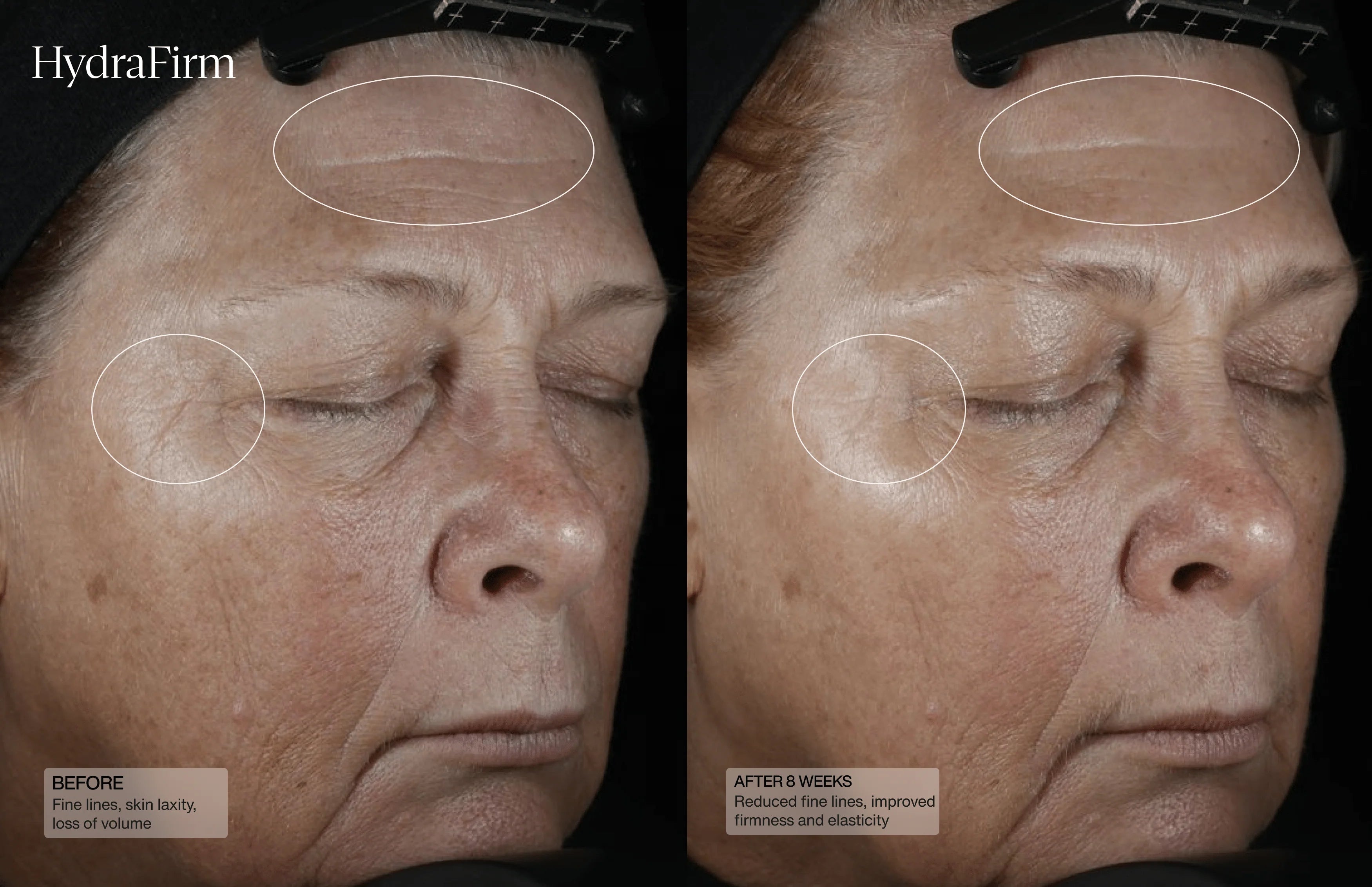 Sente HydraFirm (Dermal Contour Pressed Serum)